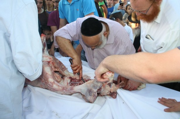 Le son removidos los órganos